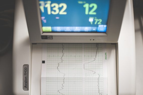 ekg_Poliklinika Nikodijevic