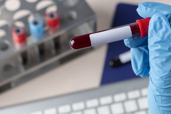 laboratorija_Poliklinika Nikodijevic